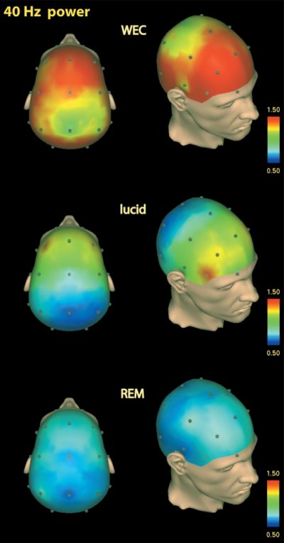 lucid-dreaming-dorsolateral-prefrontal-cortex